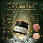 Ancient Remedy Acne Skin Care Set