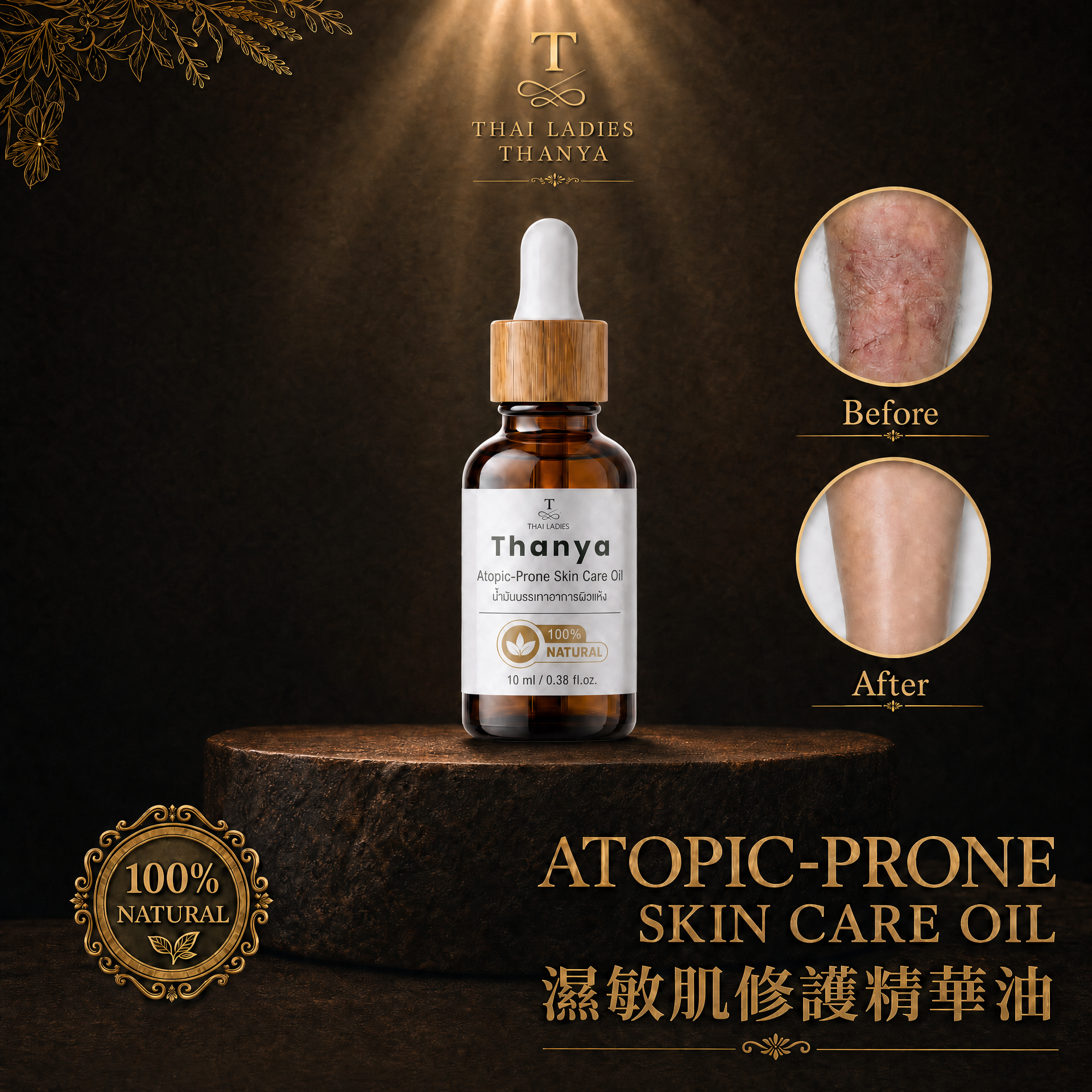 Atopic-Prone Skin Care Oil