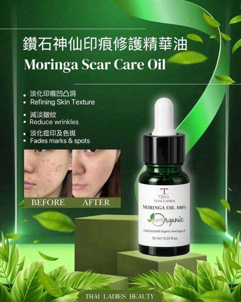Ancient Remedy Acne Skin Care Set