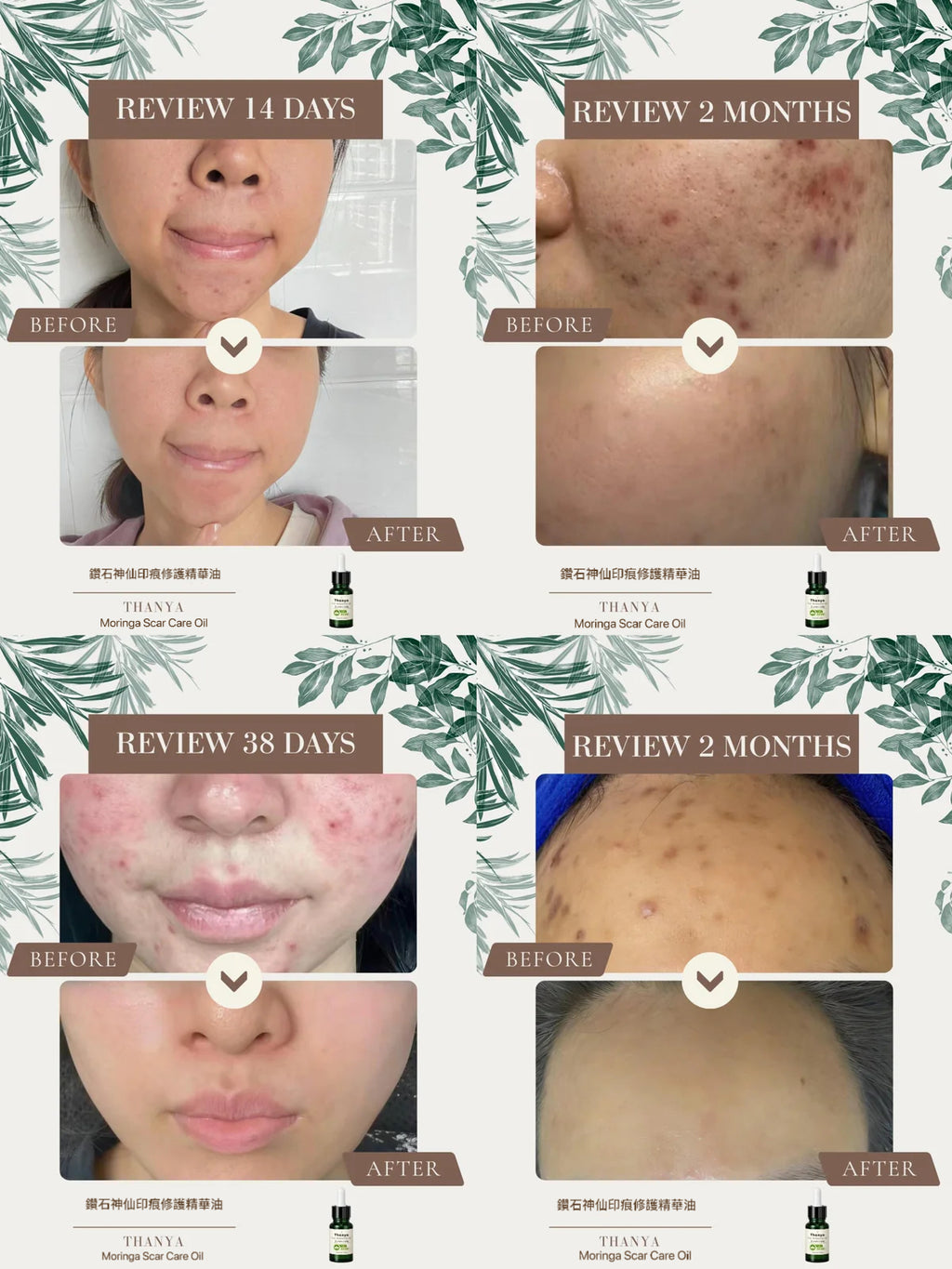 Moringa Scar Care Oil