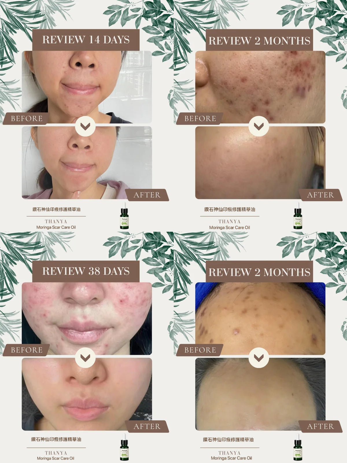 Moringa Scar Care Oil