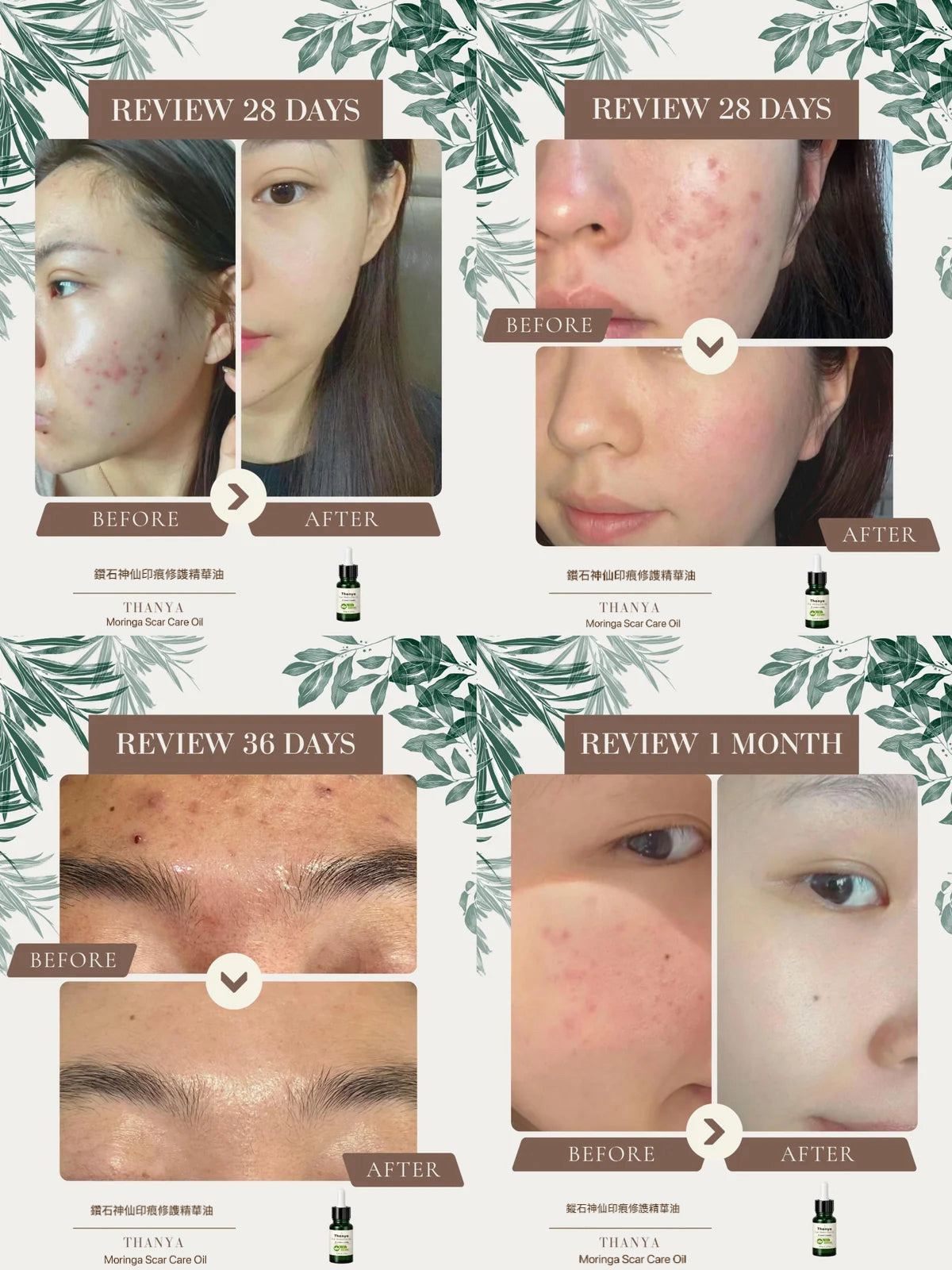 Moringa Scar Care Oil