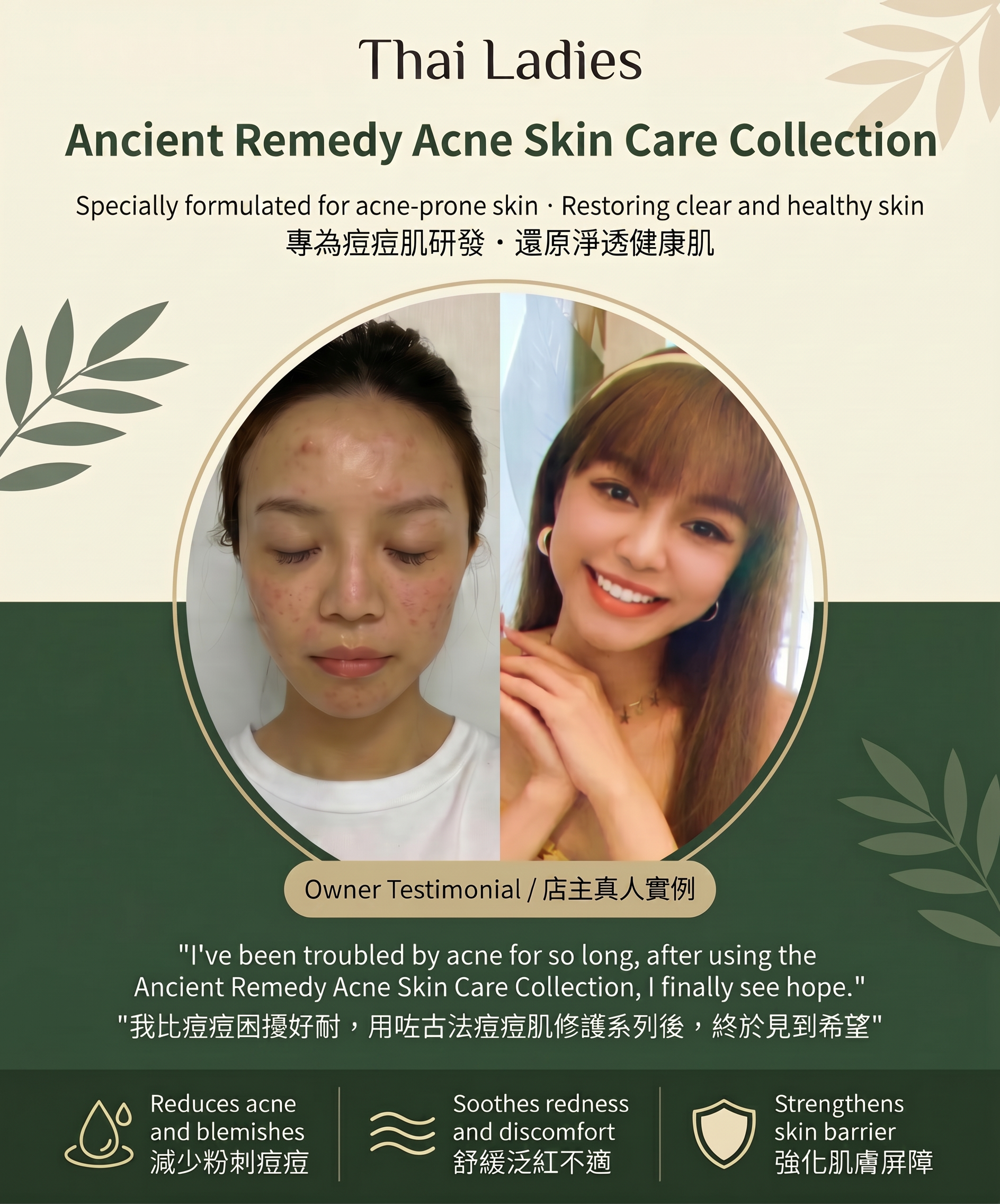 Acne Care Oil 2.0