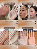 Atopic-Prone Skin Care Oil