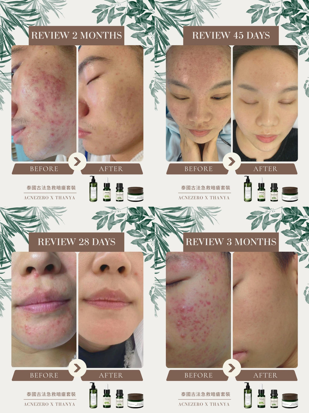 Acne Care Oil