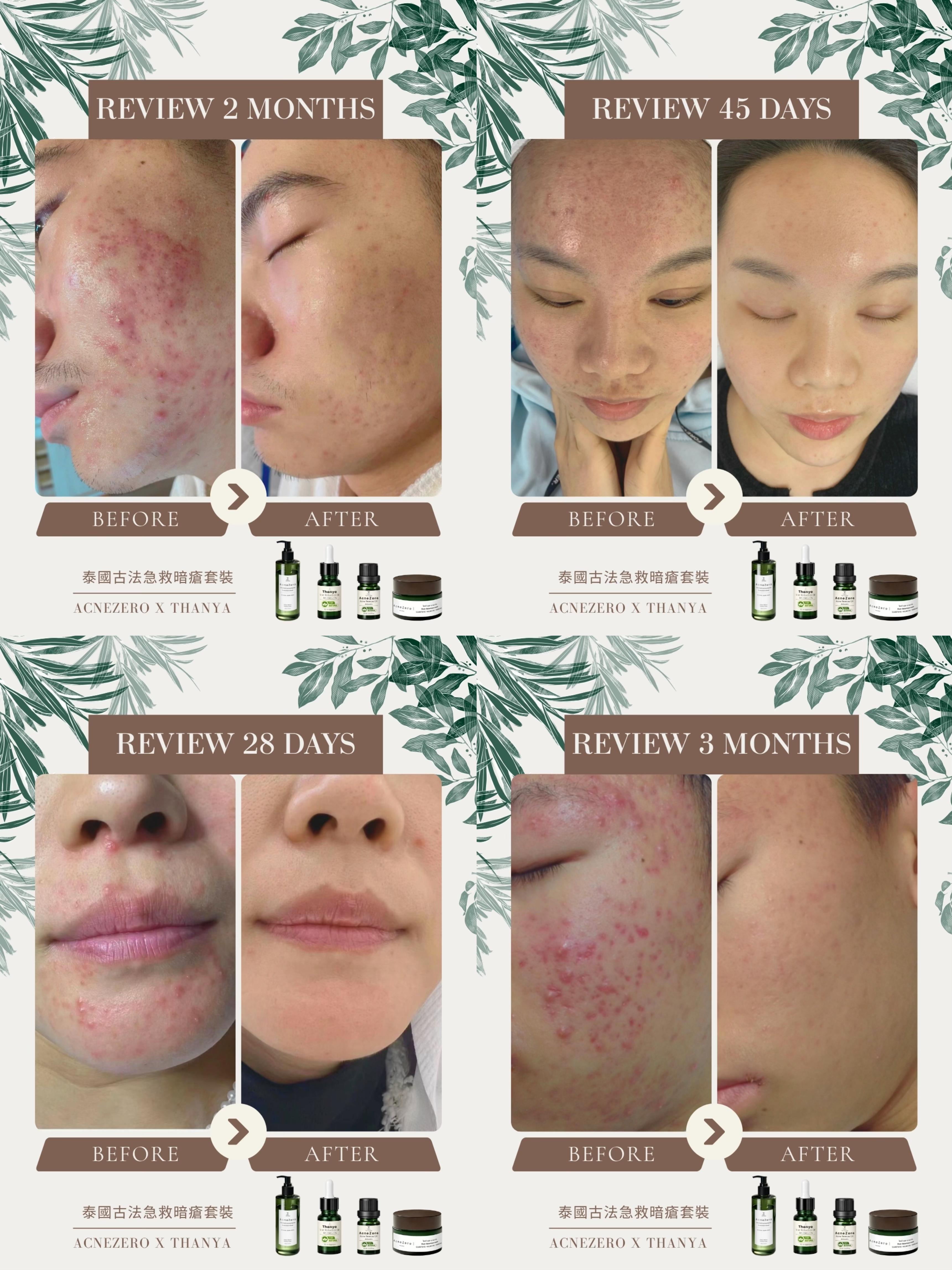 Post Acne Care Cream