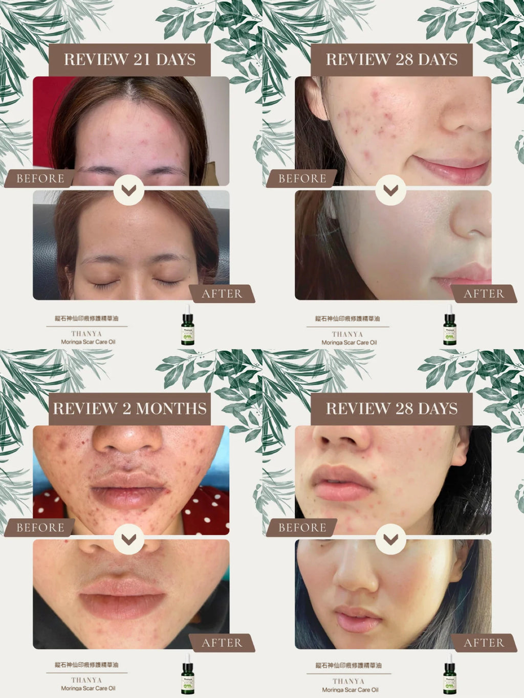 Moringa Scar Care Oil