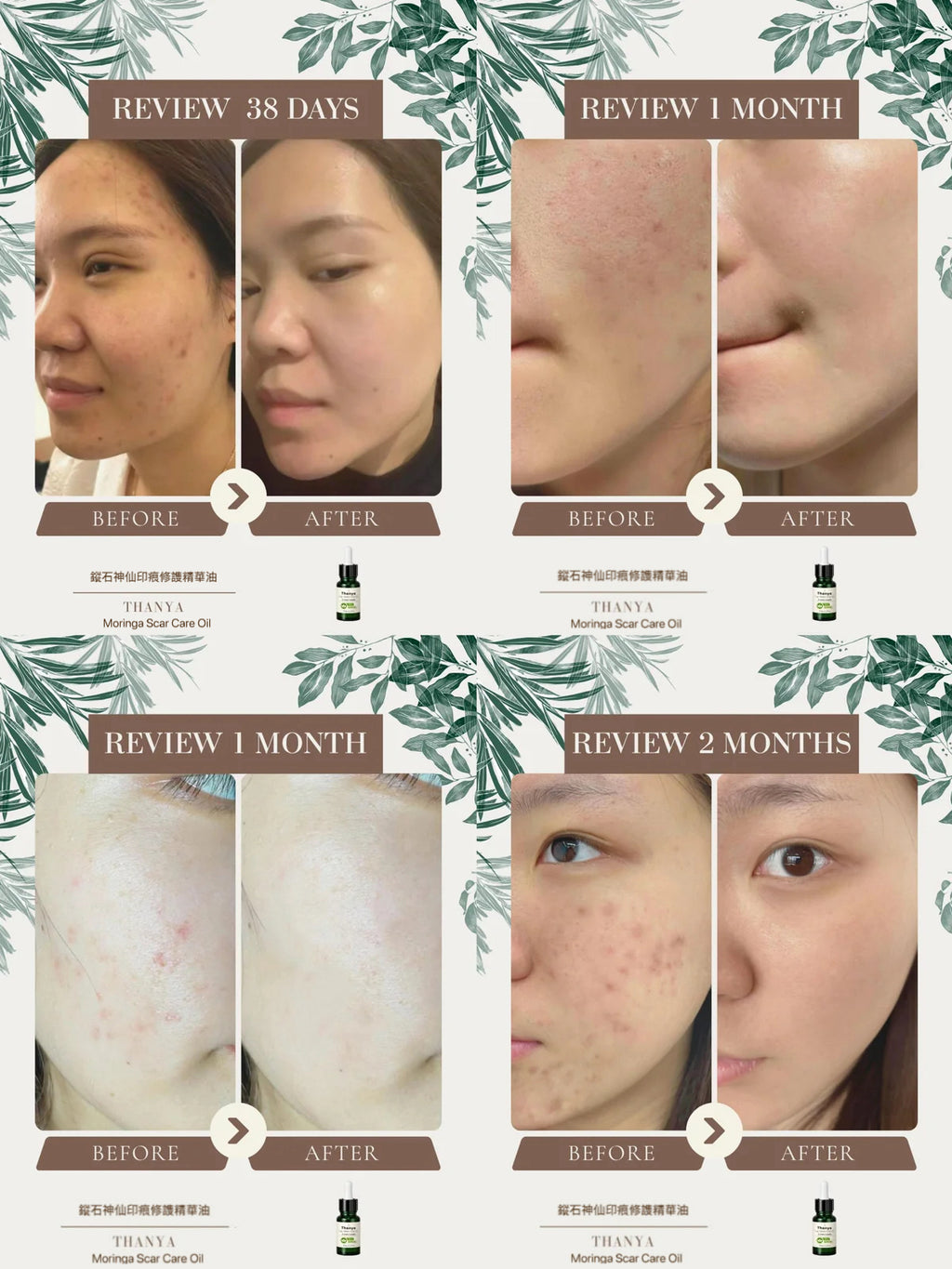 Moringa Scar Care Oil
