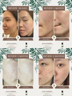 Moringa Scar Care Oil